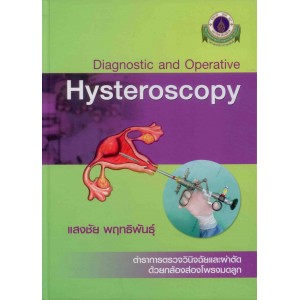 Diagnostic and Operative Hysteroscopy