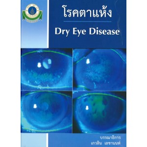 โรคตาแห้ง Dry eye disease